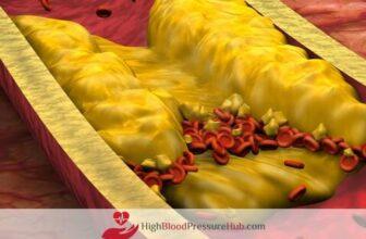 One Cup of Pomegranate Juice Daily May Help Reduce Artery Blockage