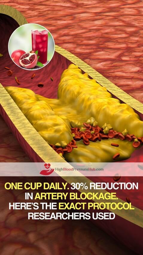One Cup of Pomegranate Juice Daily May Help Reduce Artery Blockage